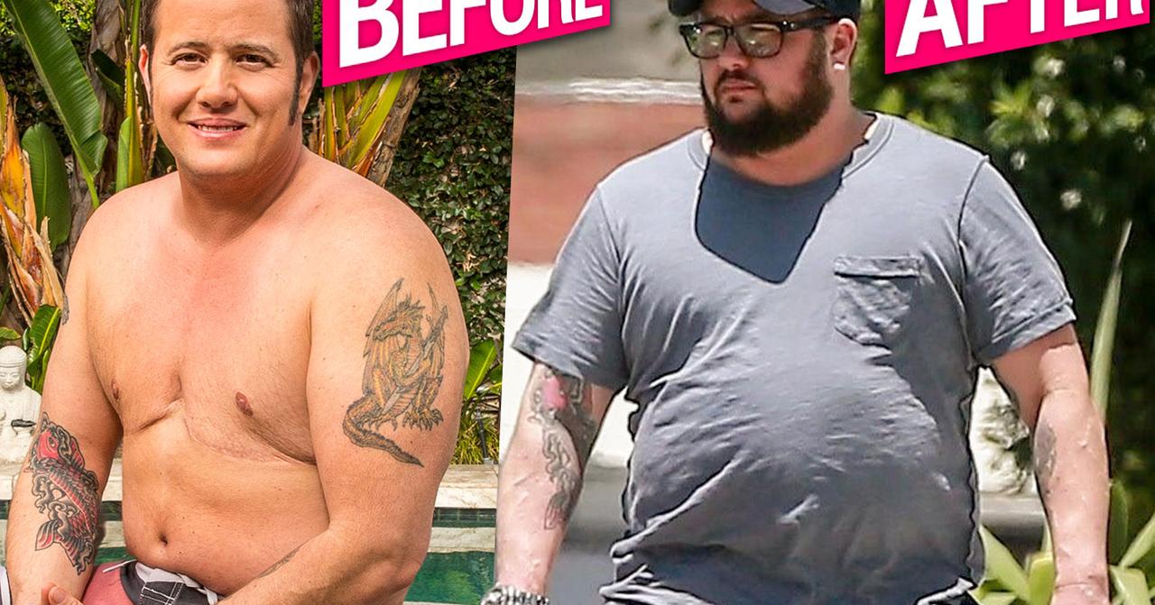 Chaz Bono Cher’s Kid’s Extreme Weight Loss Gains Are Killing Him