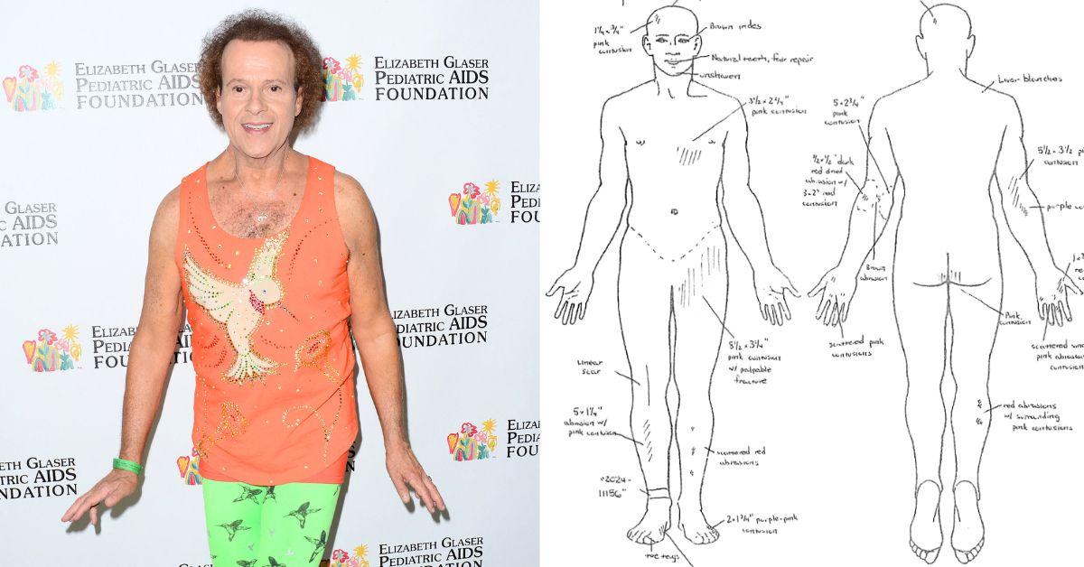 Composite Photo Richard Simmons Autopsy