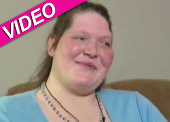 //tanya angus gigantism