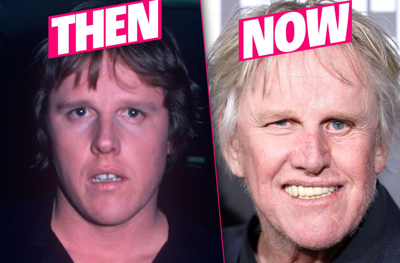 Gary Busey Admits Plastic Surgery Makeover In New Tell All Book