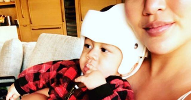 Chrissy Teigen Son Miles Needs Helmet Misshapen Head