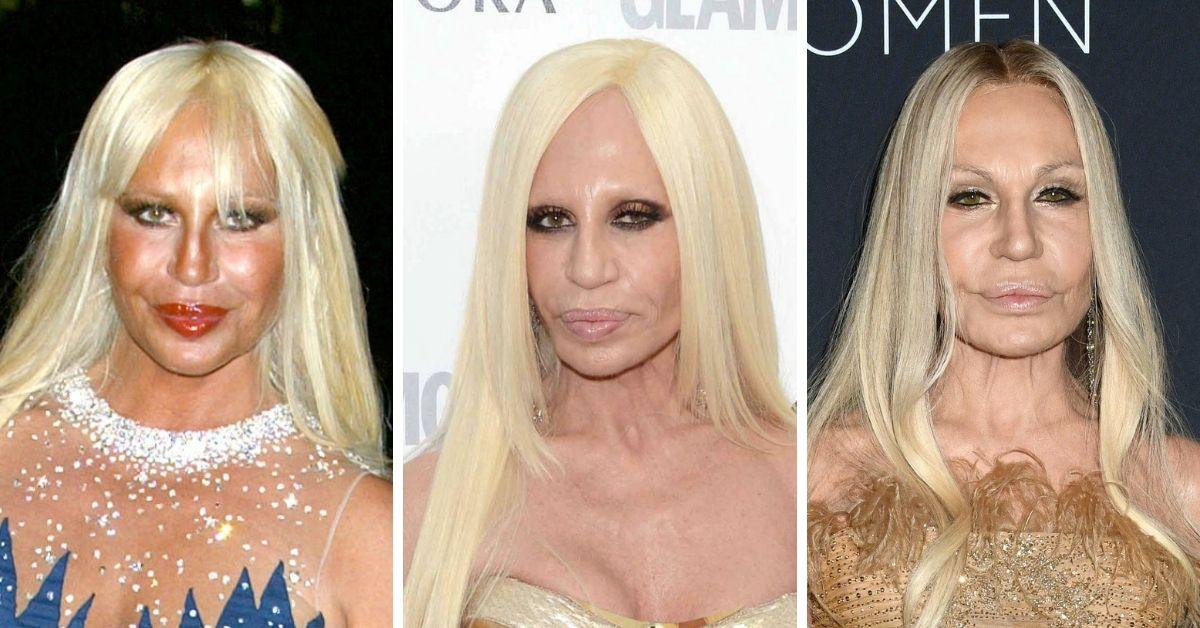 Donatella Versace’s Transformation Revealed In Before & After Photos