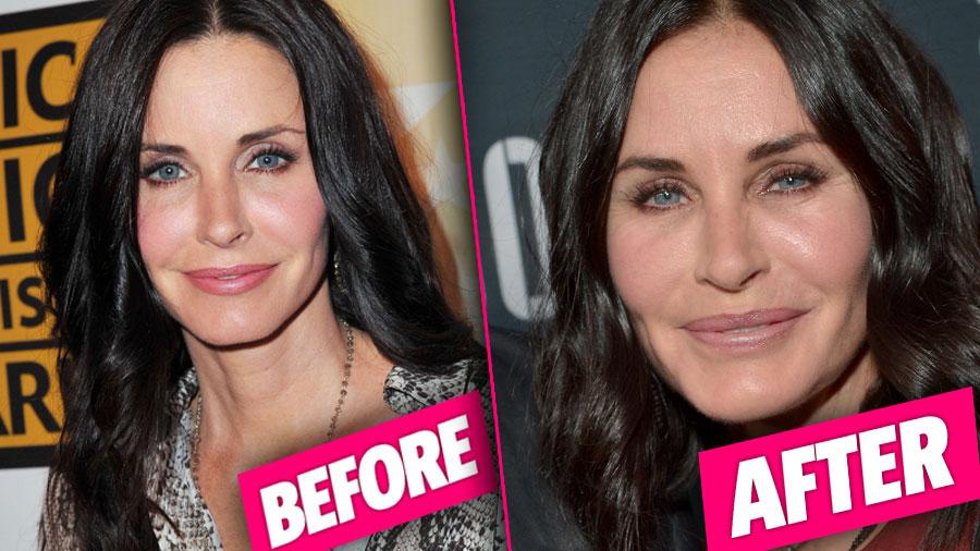 //Courtney Cox Plastic Surgery pp