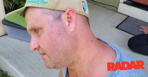 zachery ty bryan injuriesjpg