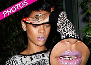 //rihanna grill splash
