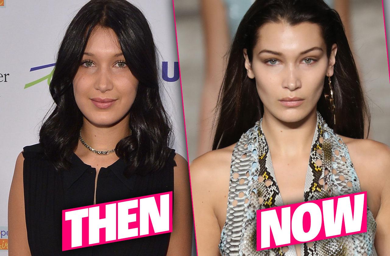 Bella Hadid Nose Job Before And After