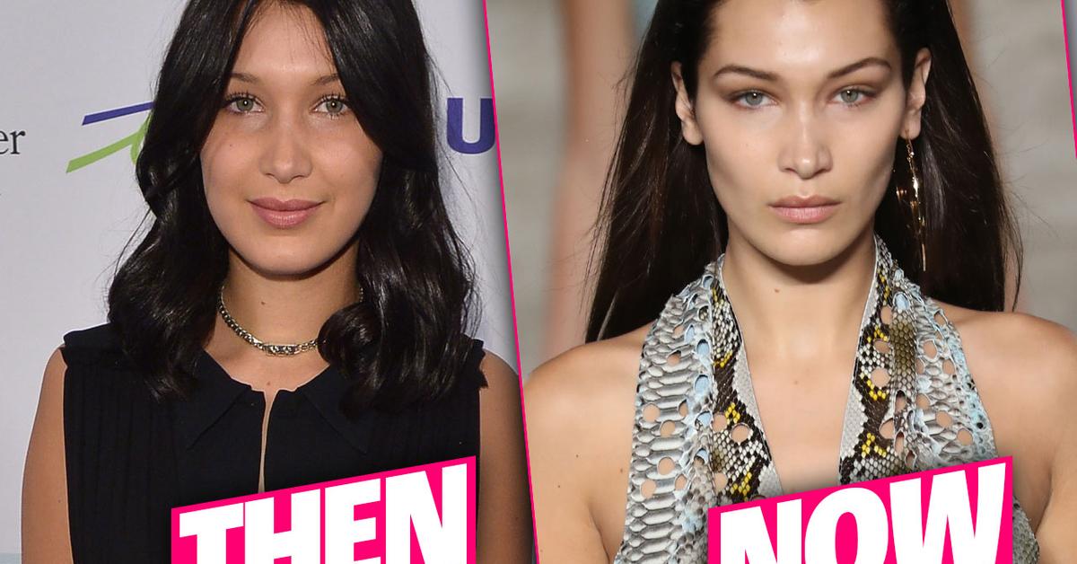 Bella Hadid Plastic Surgery Makeover Exposed By Top Doctors