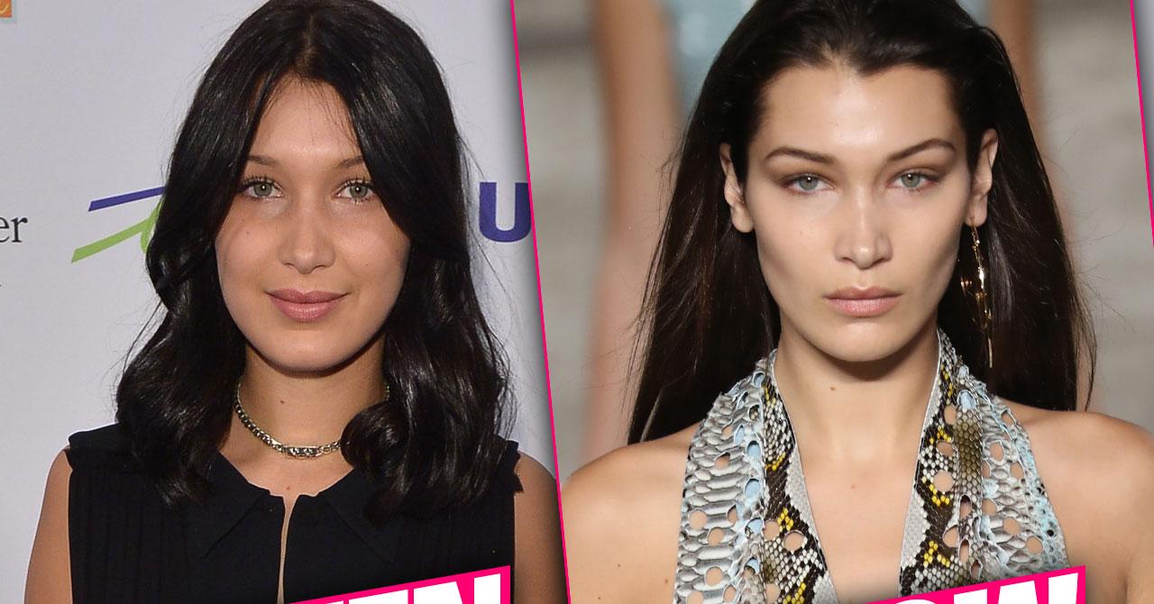 Bella Hadid Plastic Surgery Makeover Exposed By Top Doctors