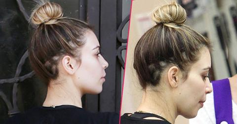 Kim Kardashian's Shocking Bald Patches