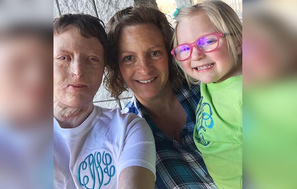Burn Victim Courtney Waldon's Mom Slams Monster Husband Who Left Her