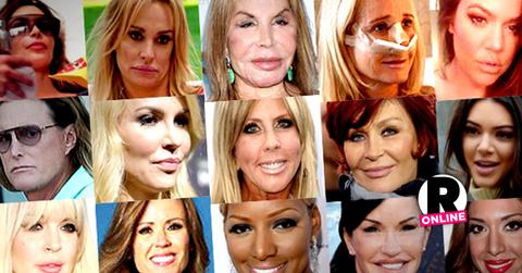 //reality stars plastic surgery slideshow pp