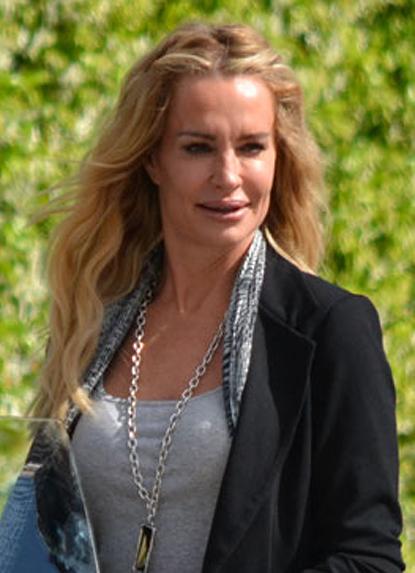 //taylor armstrong reality star plastic surgery