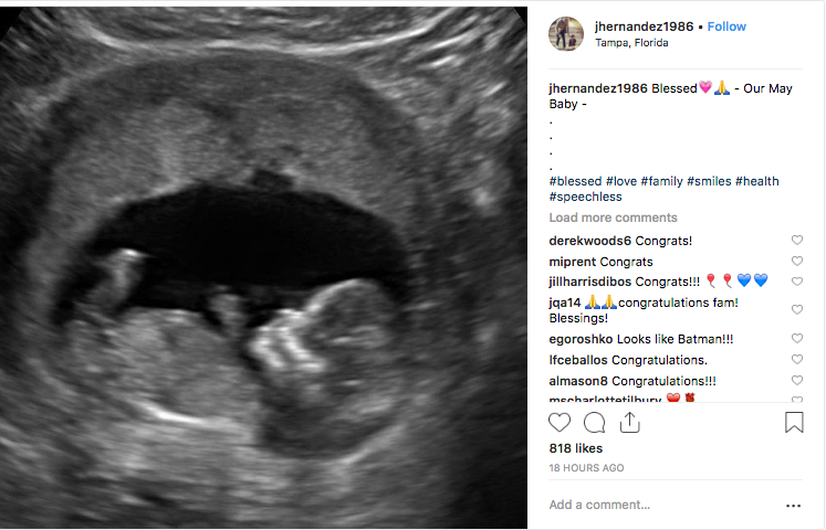 Aaron Hernandez's Brother Expecting Baby Boy