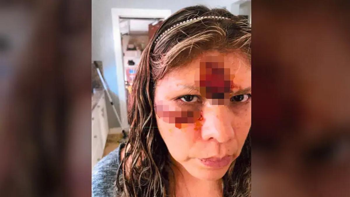 The housekeeper said she feared for her life during the attack.