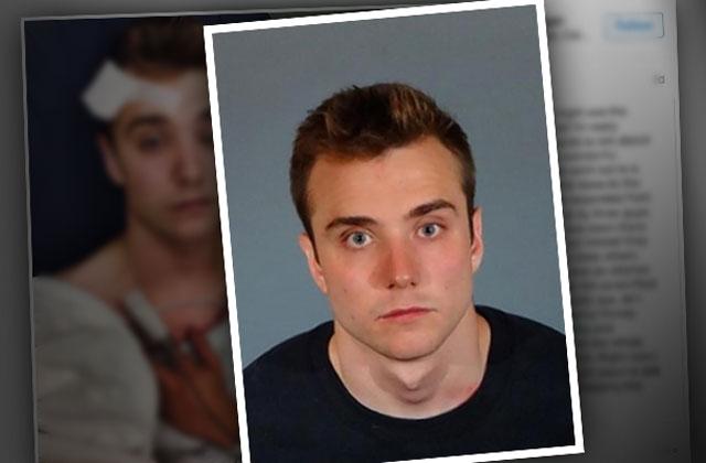Lgbt Youtube Star May Have Faked Hate Crime Police Say 5295