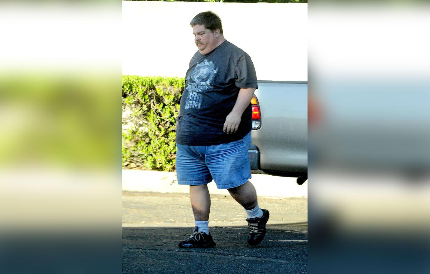 //barbara streisand stepson jess brolin obese amputation fears