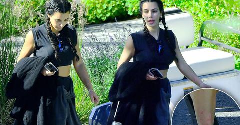 Kim Kardashian Leg Rash