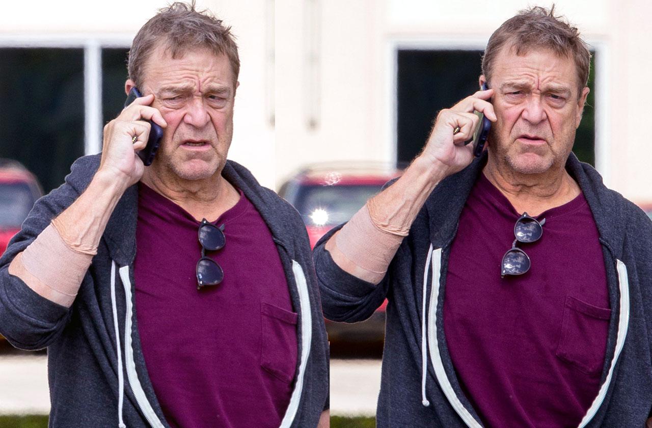 //John Goodman Arm Injury Stressed PP