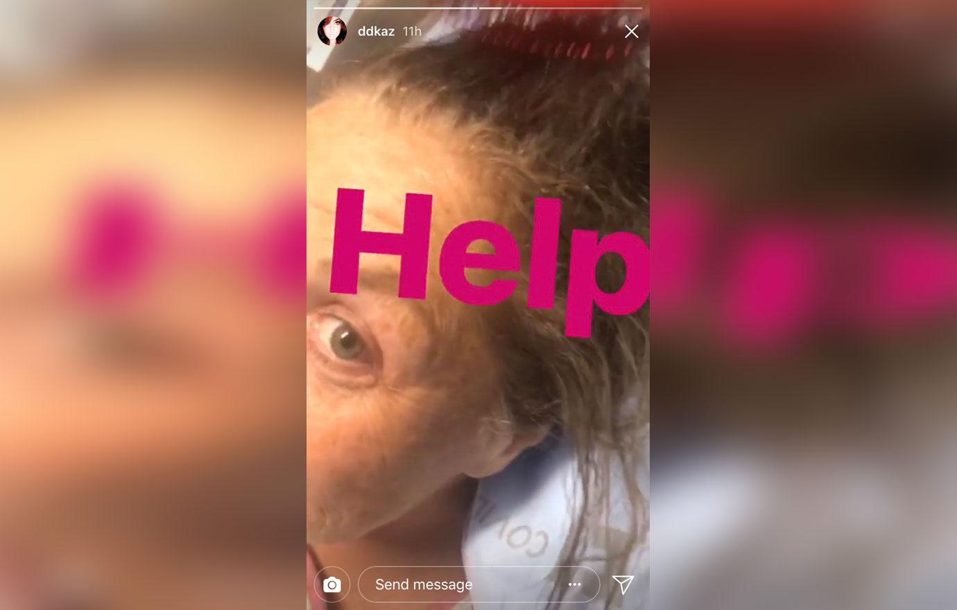 Abby Lee Miller Shows Off Scars, Removes Wig During Cancer: Pics