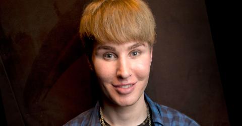 Botched Star Tobias Strebel Reported Missing