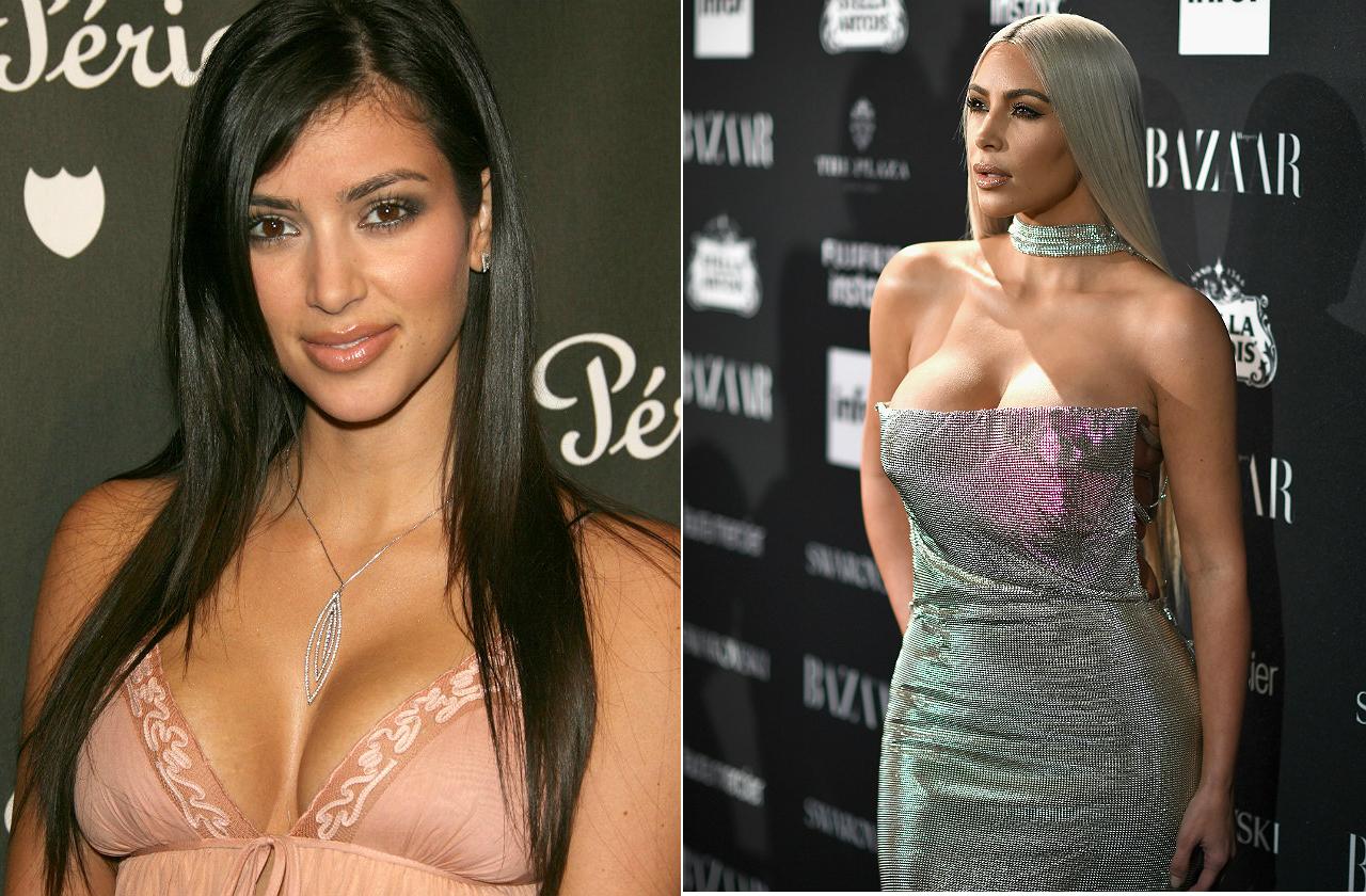kim kardashian breast reduction Image 1