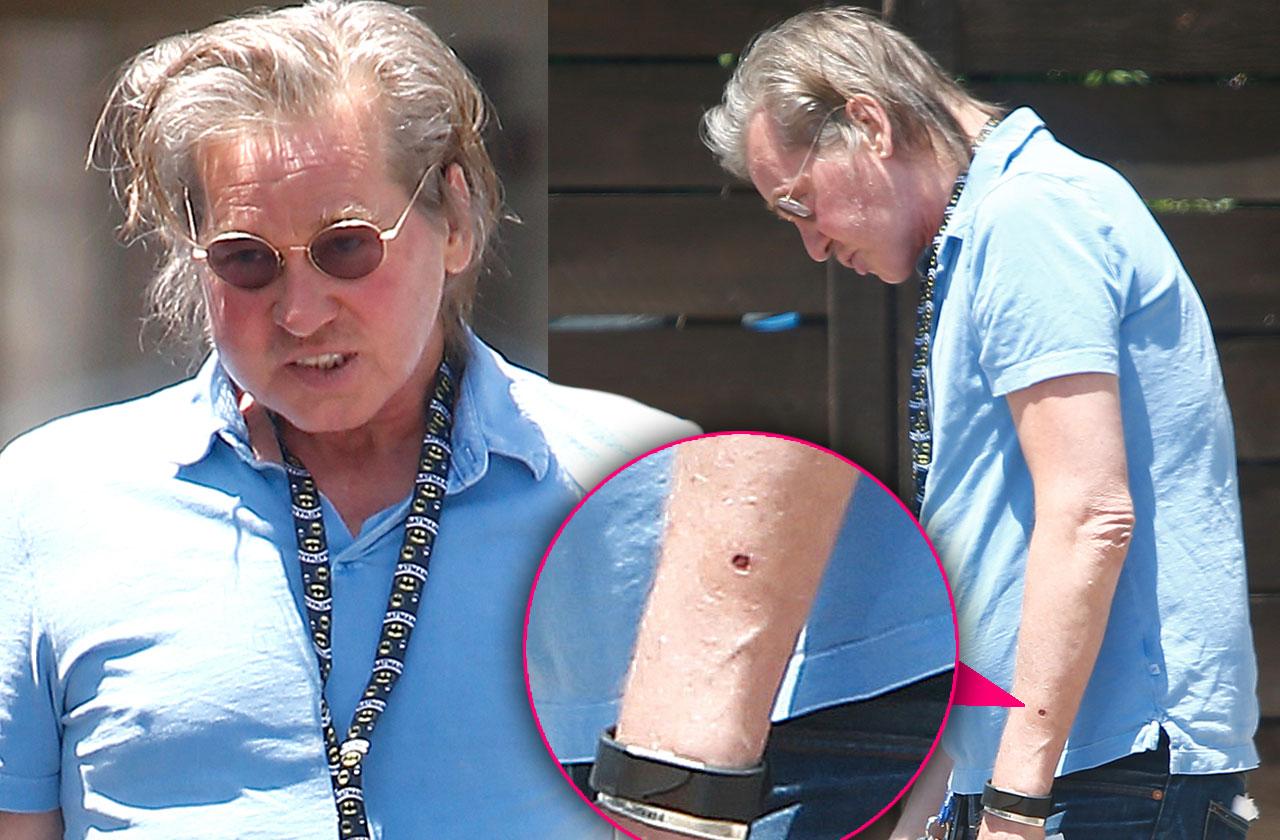 Val Kilmer Cancer Free