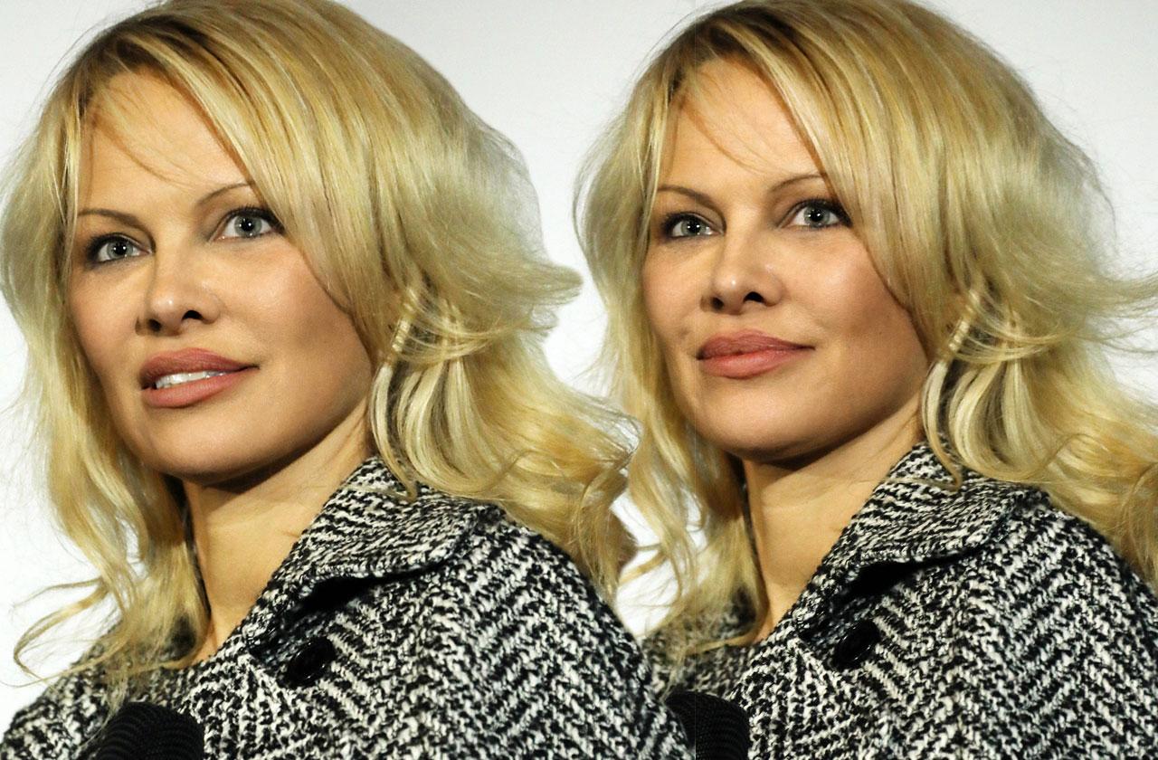 Pamela Anderson New Face Plastic Surgery Film Premiere Marseille