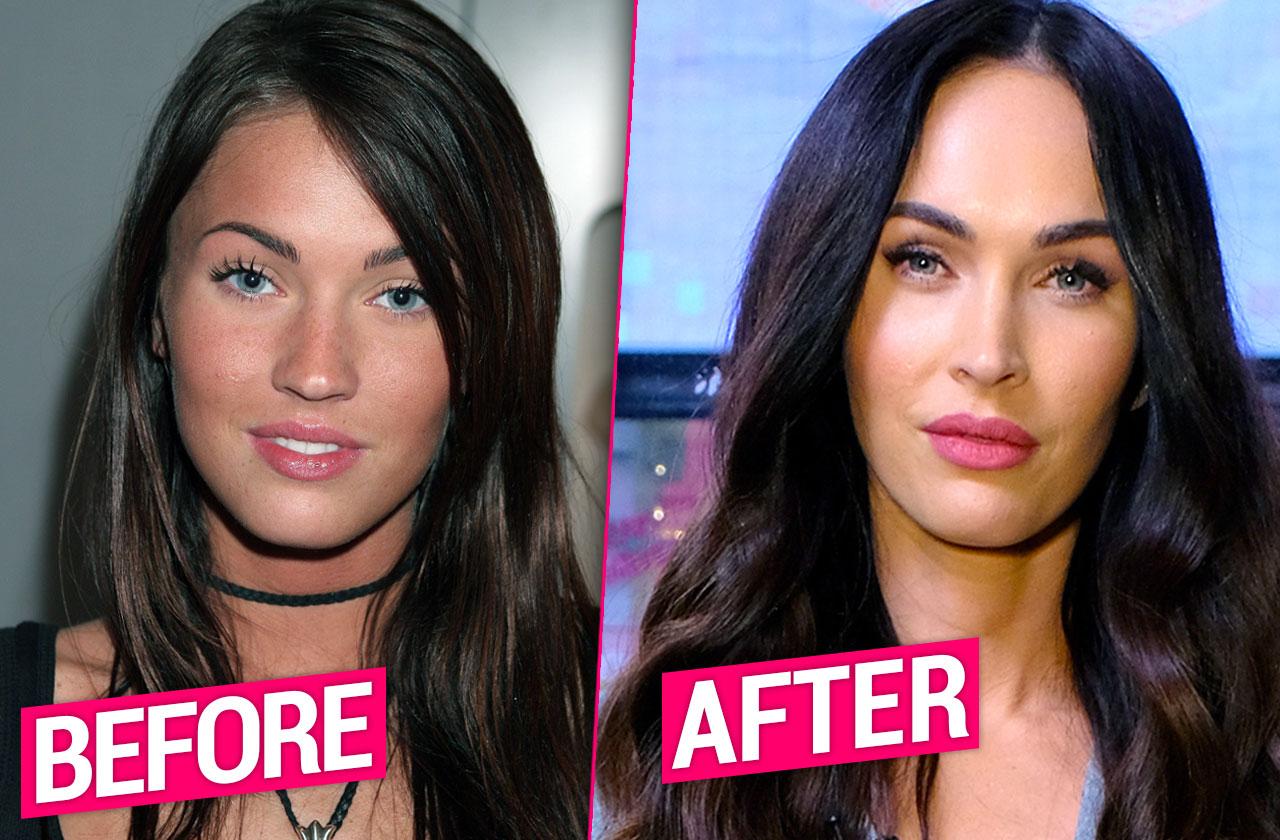 Megan Fox Nose Job Before After