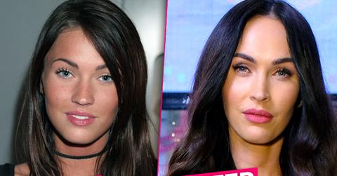 //Megan Fox Plastic Surgery pp
