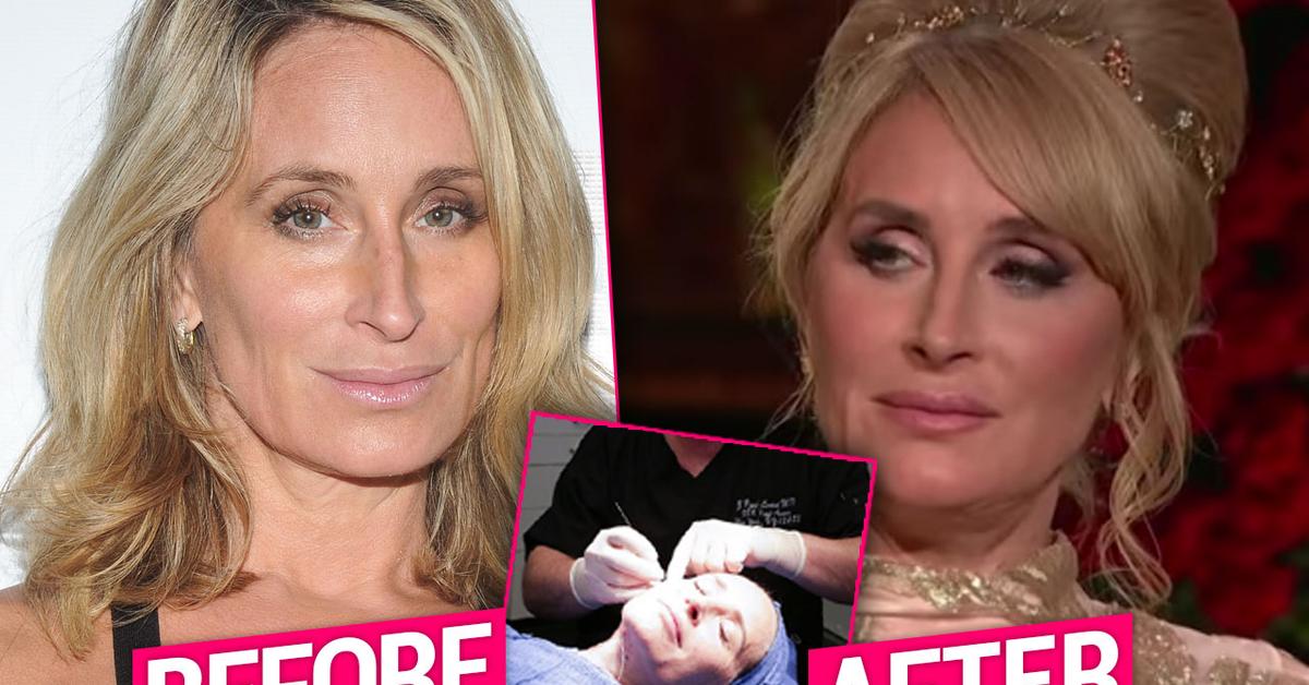 Sonja Plastic Surgery Makeover For ‘RHONY’ Reunion
