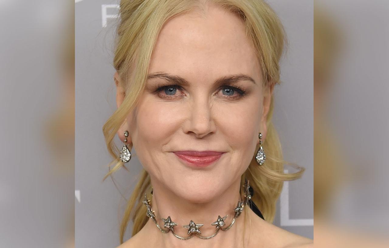 Nicole Kidman’s Plastic Surgery Transformation -- Top Docs Claim ...