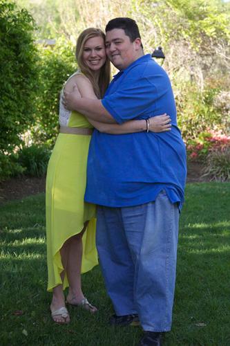 Unlikely Couple Anorexic Woman Obese Man Find Love