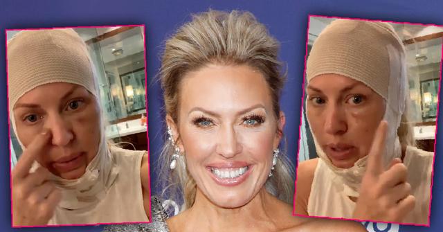 Braunwyn Windham Burke Gets Cosmetic Facial Work