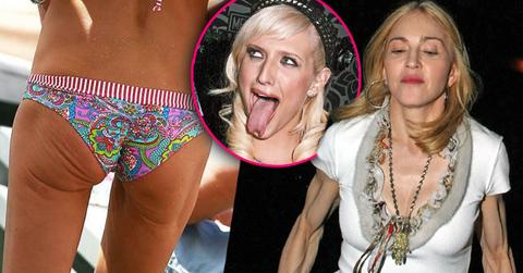 //extreme celebrity body flaws