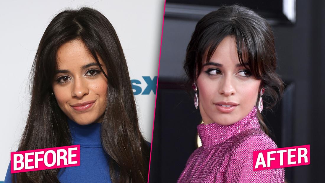 Camila Cabello's Alleged Plastic Surgery Transformation Exposed(00)
