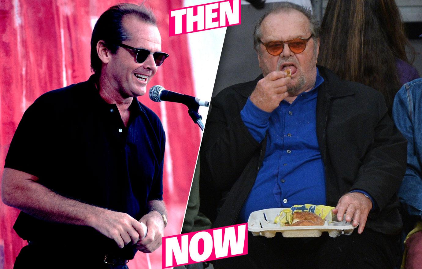 jack nicholson fat gastric bypass surgery