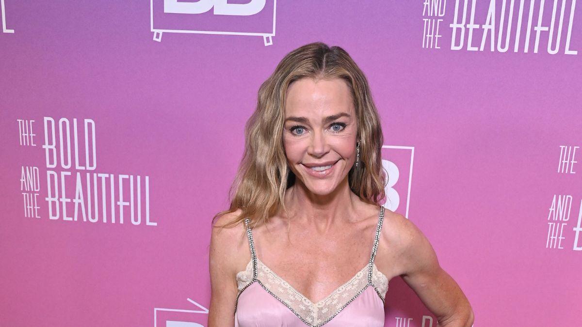 Denise Richards' plastic surgery makeover has signaled a new life chapter with a noticeably refreshed look.