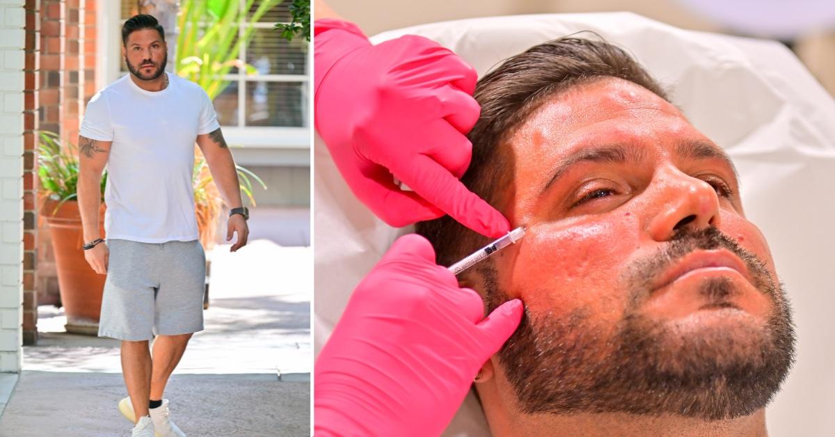 Ronnie Ortiz-Magro Gets Botox, Facial In L.A.