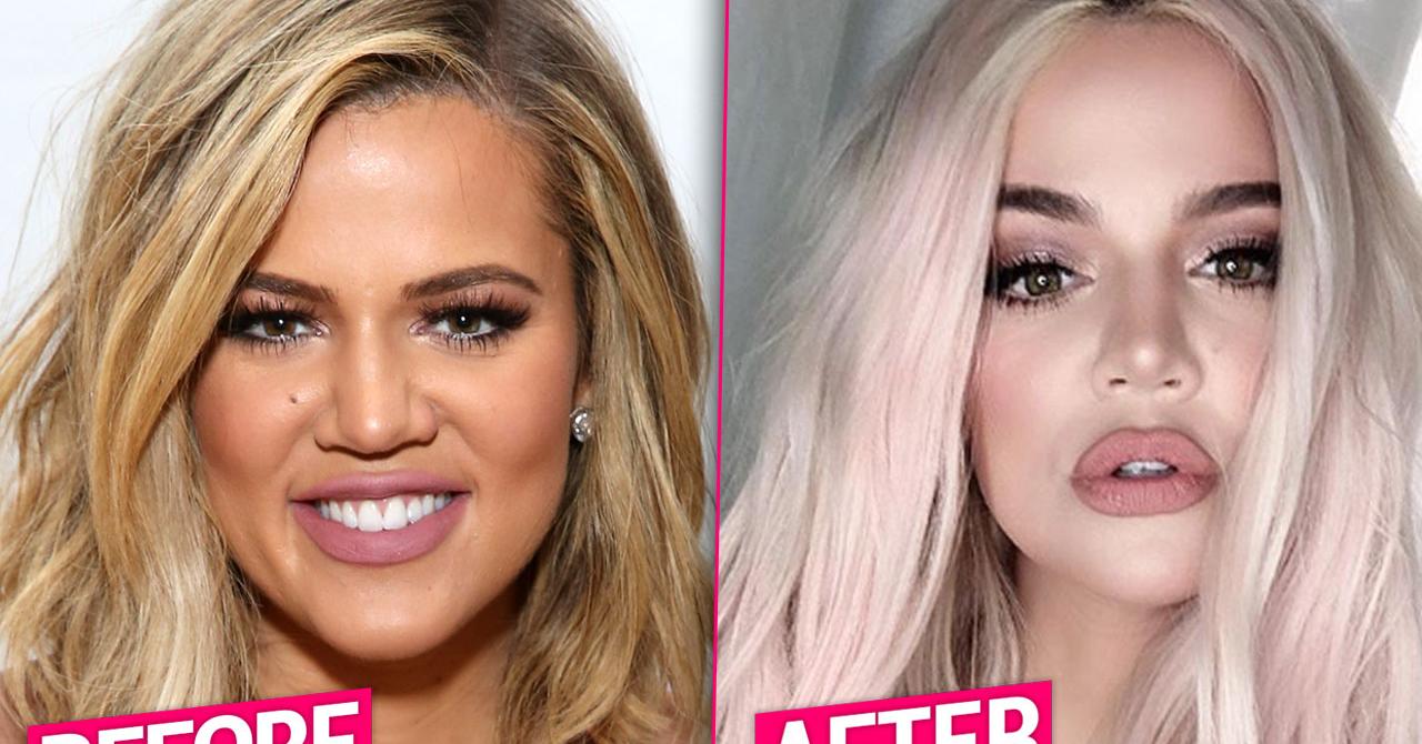 Khloe Kardashian Unrecognizable After Massive Plastic Surgery Makeover