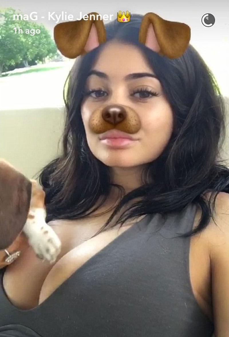 //Kylie Jenner Boob Job Breast Augmentation