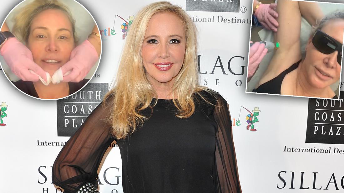 'RHOC' Star Shannon Beador Going Overboard With Plastic Surgery