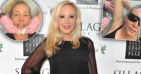 'RHOC' Star Shannon Beador Going Overboard With Plastic Surgery