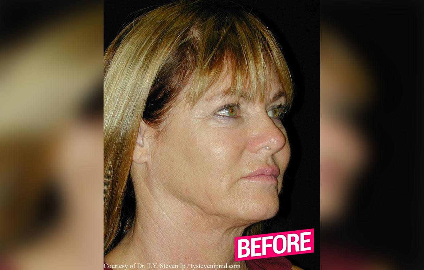 //rhoc Jeana Keough plastic surgery makeover