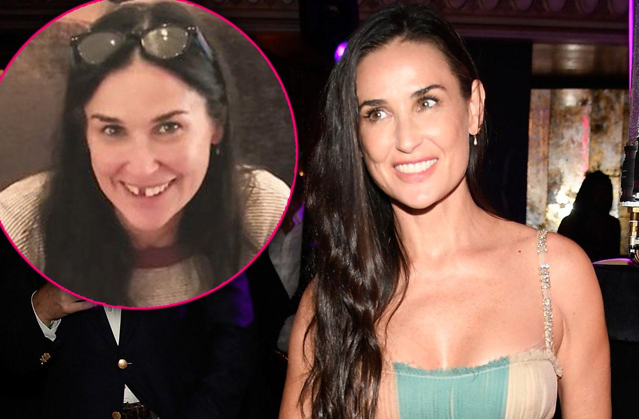 Demi Moore Teeth