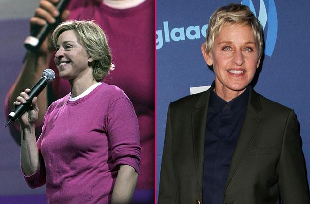 Ellen Degeneres Surgery breast reduction