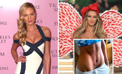 //candice swanepoel this years weight loss winners and sinners