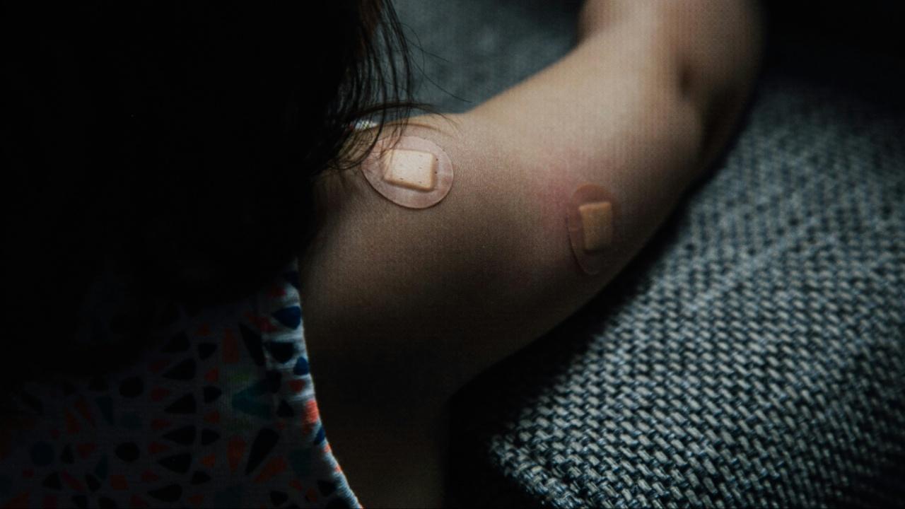 Child injuries