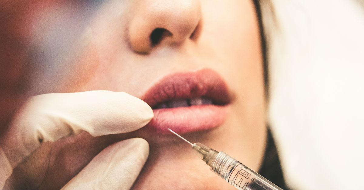 Photo of lip injection