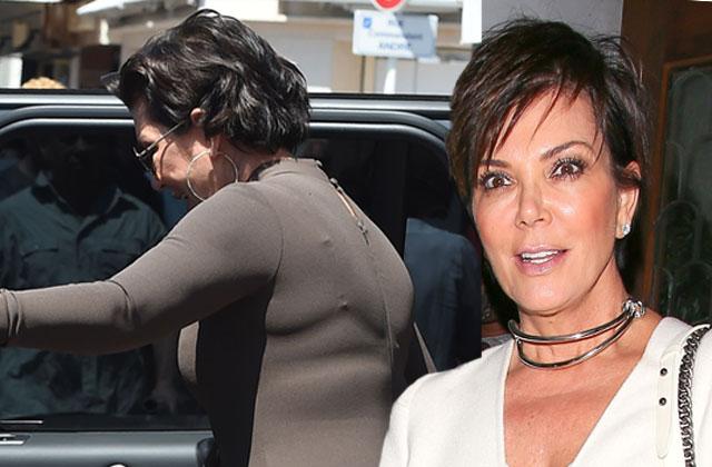 //kris jenner plastic surgery pp