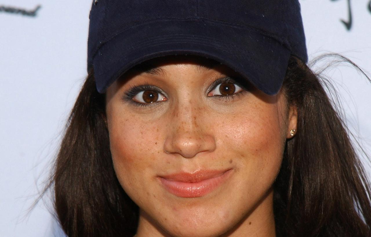 27 Celebrity nose jobs before & after